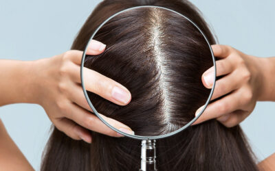 Start at the Root: Scalp Health and Hair Loss