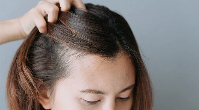 Is Postpartum Hair Loss a Real Thing? What Can You Do to Help It?